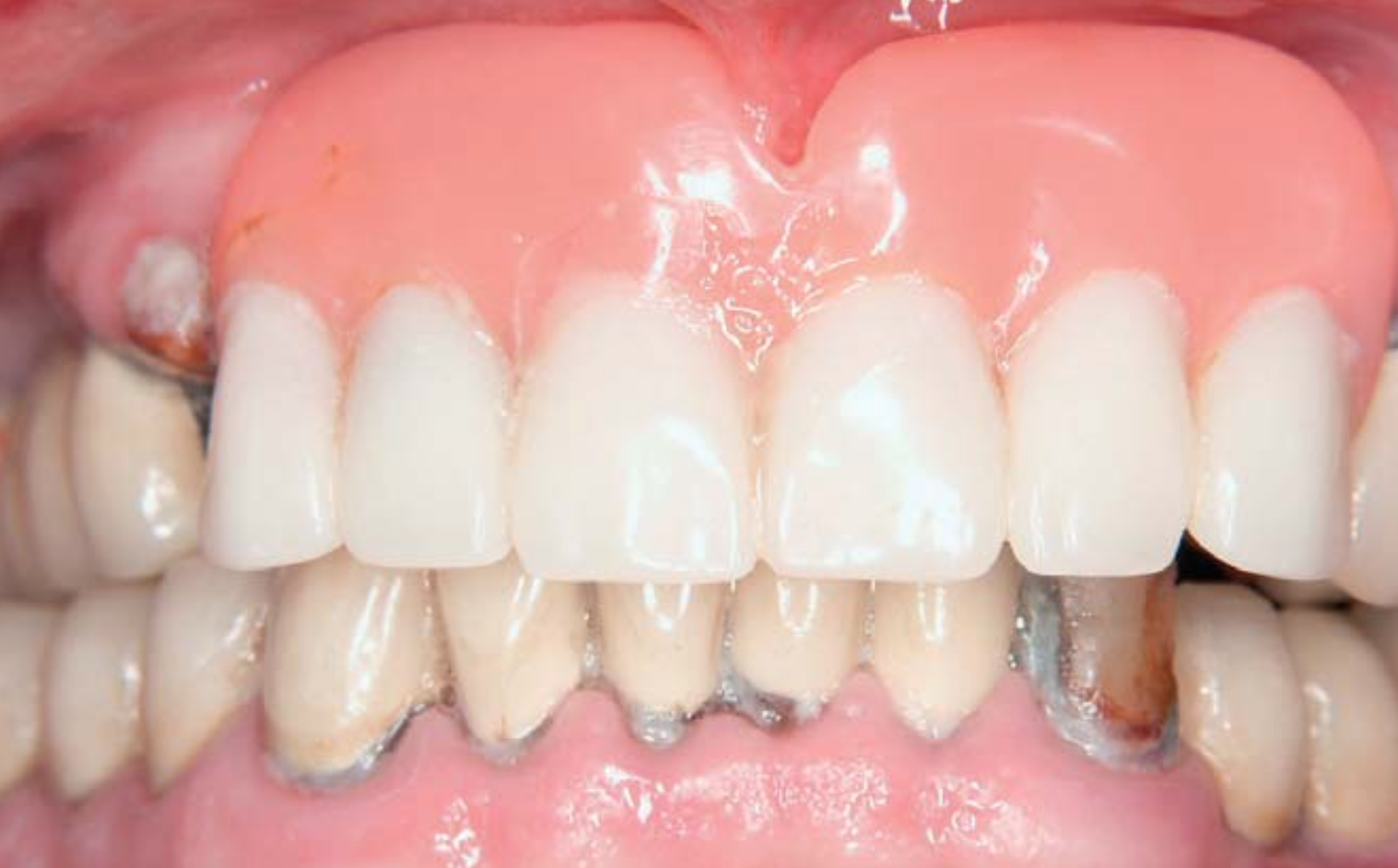 Bildschirmfoto 2018-06-25 um 17.28.33.png